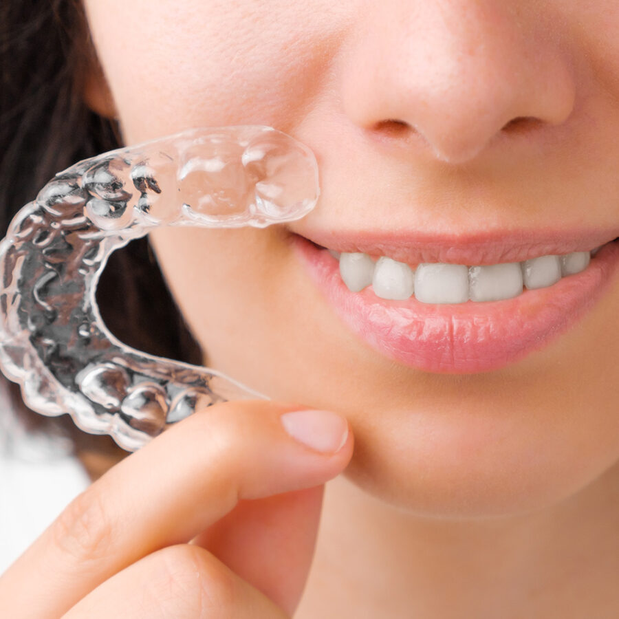 Estetisk tannbehandling usynlig tannregulering