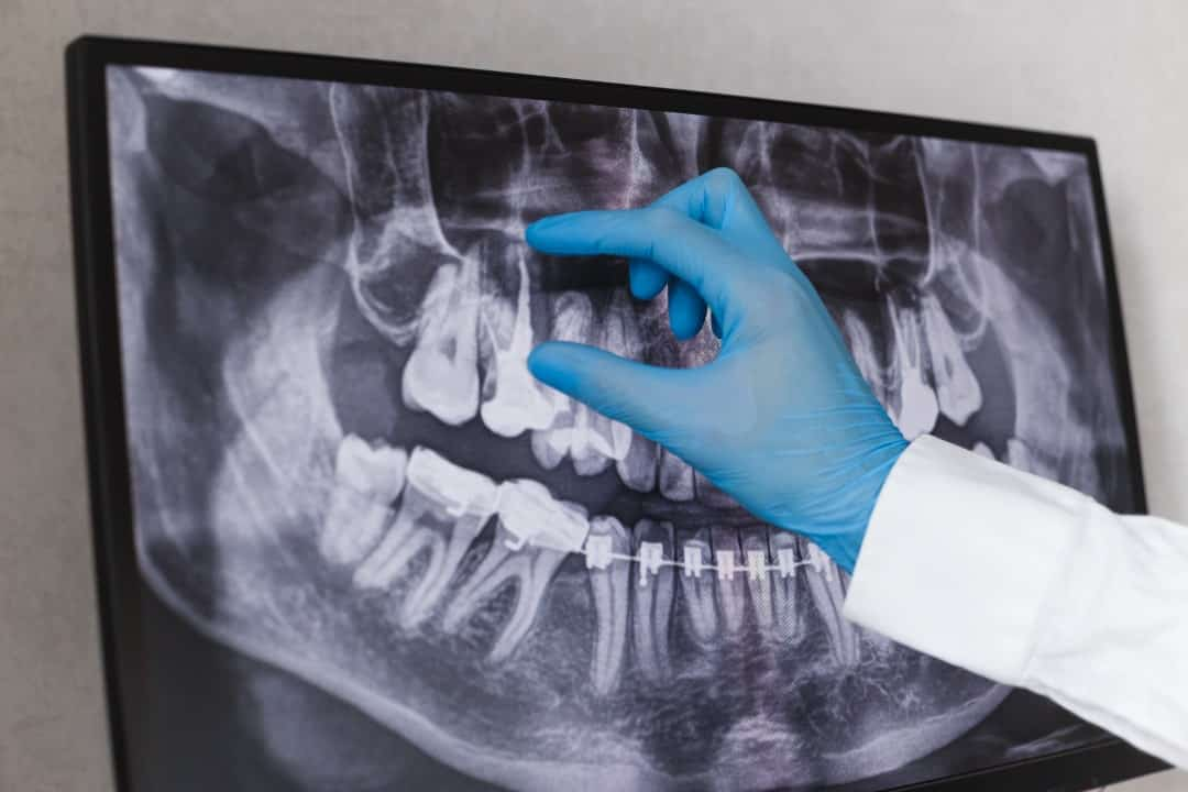 Tannlegen tar rønkenbilder som en del av diagostisering og behandling