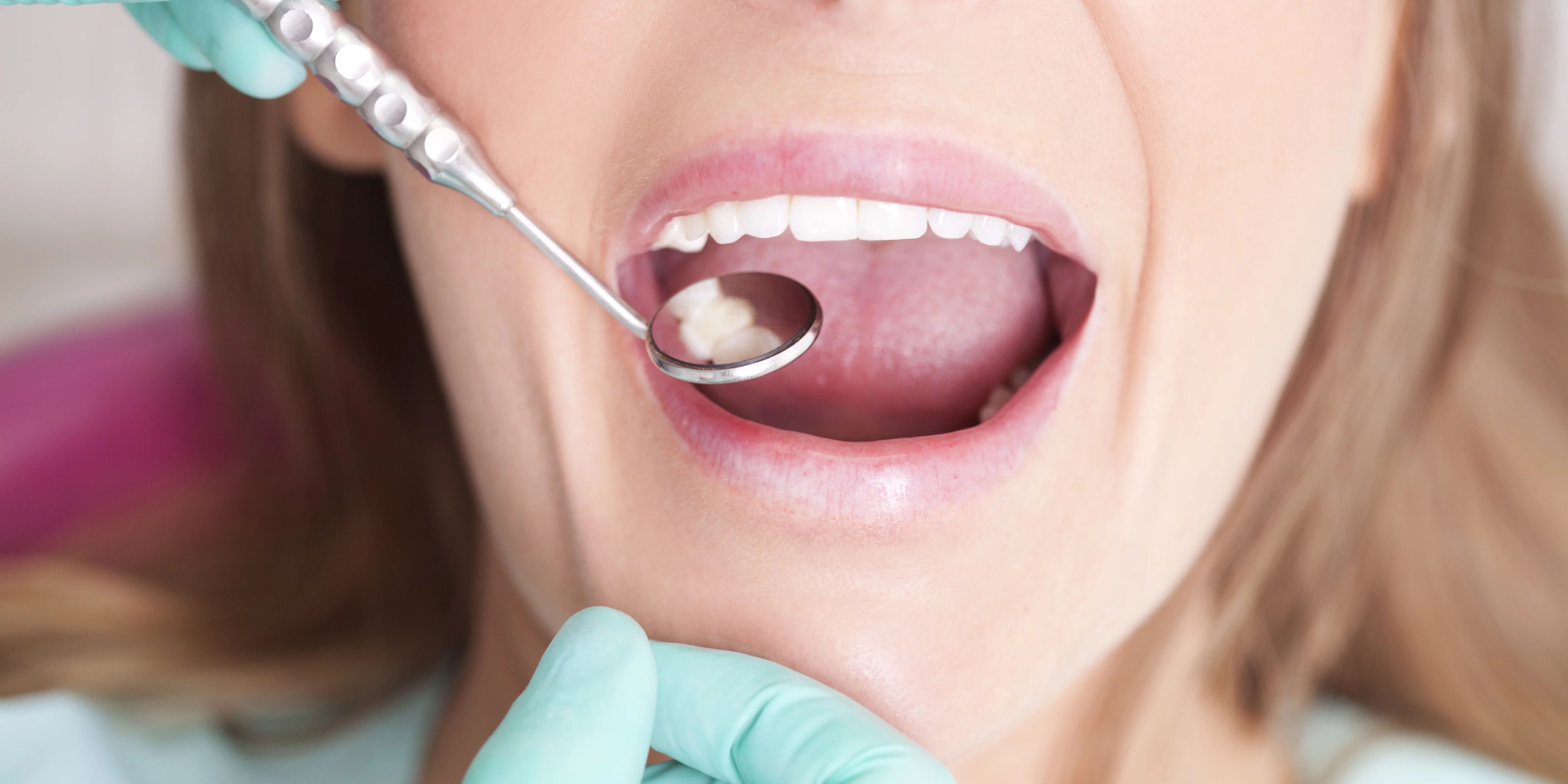 Tannlegen sjekker tennene til en pasient