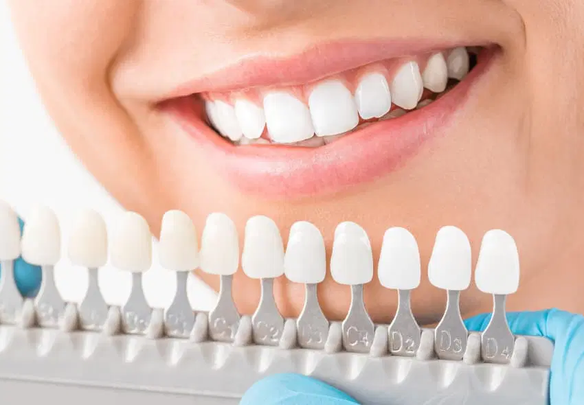 Kvinne som sammenligner falske tenner til egen tannfarge