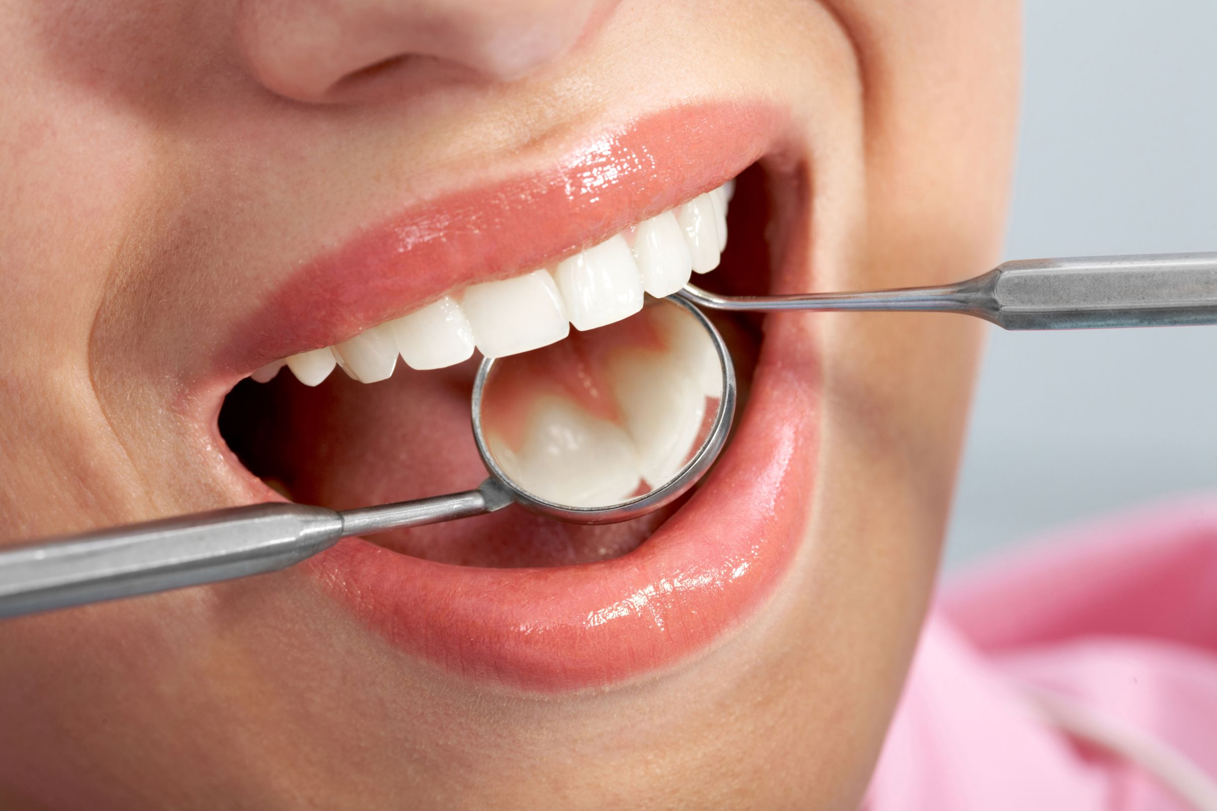 Regelmessige undersøkelser hos tannlegen kan forhindre tannråte