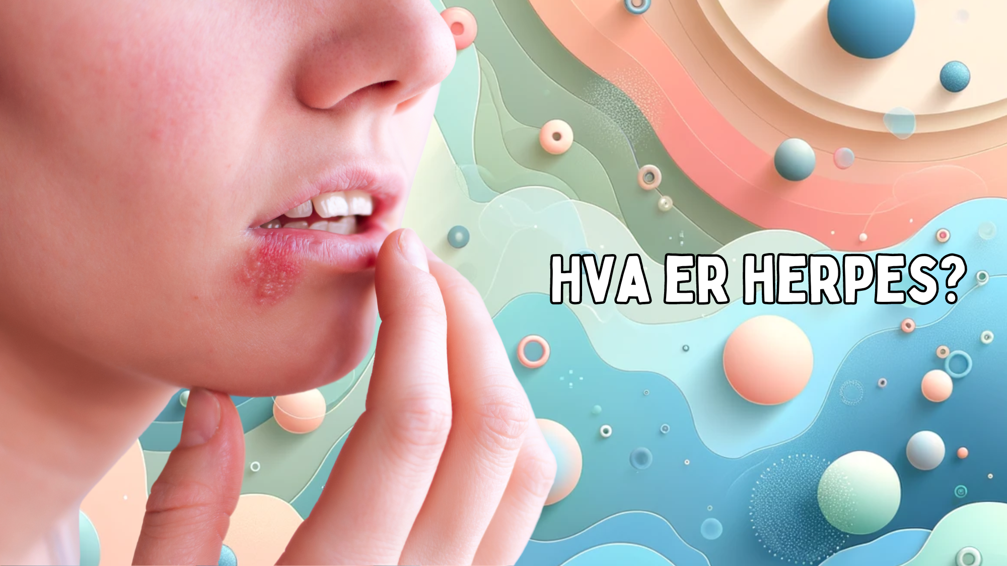 Bilde av en person som peker på munnherpes, med teksten 'HVA ER HERPES?' på en pastellfarget bakgrunn.