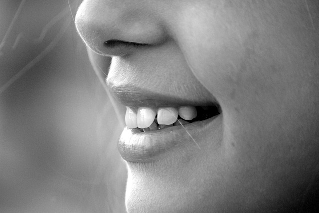 Kvinne som smiler med tenner uten tannstein