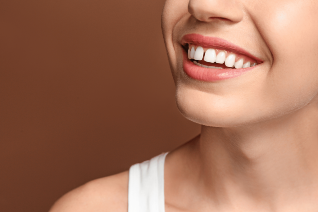 Kvinne med overbitt og mellomrom mellom tennene